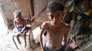 Hambre en Venezuela – desnutrición entre los niños y la caída de la producción de alimentos